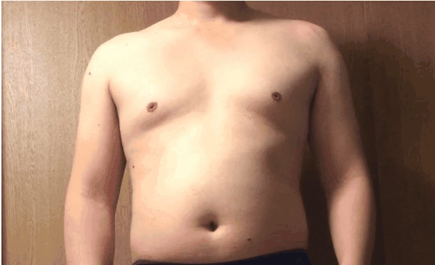 腹の質が違う連続写真