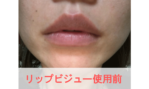 リップビジュー使用前の女性の唇の写真